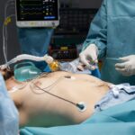 Exploring the Two Techniques of Esophagectomy