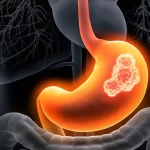 Gastrointestinal doctor in Dombivli